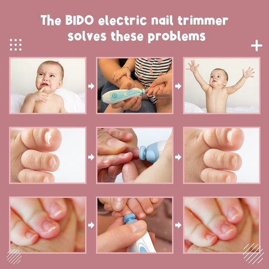 Vatsalcare TrimSafe™ Baby Nail Trimmer